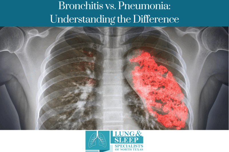 Bronchitis vs. Pneumonia: Understanding the Difference